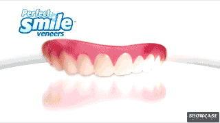 Perfect Smile Veneers